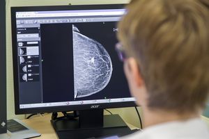 Röntgenbild der Brust
